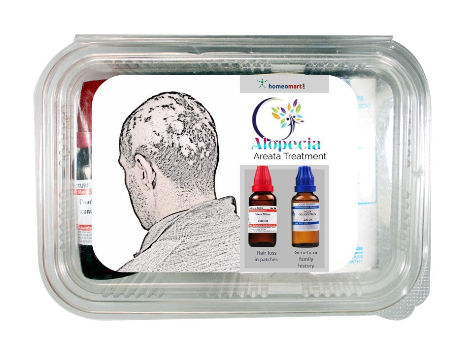 Alopecia Areata treatment Homeopathy medicines