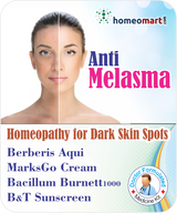 best melasma treatment 2020, how to cure melasma from the inside