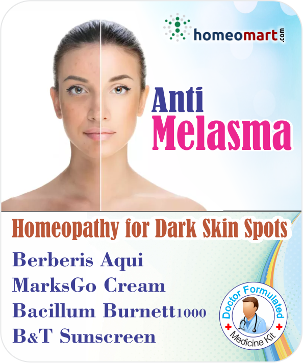 best melasma treatment 2020, how to cure melasma from the inside