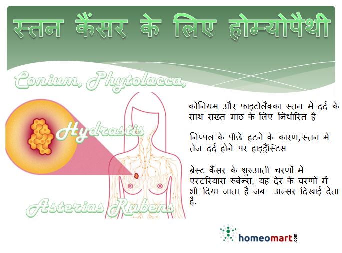 breast cancer treatment in hindi ब्रेस्ट कैंसर (स्तन कैंसर)