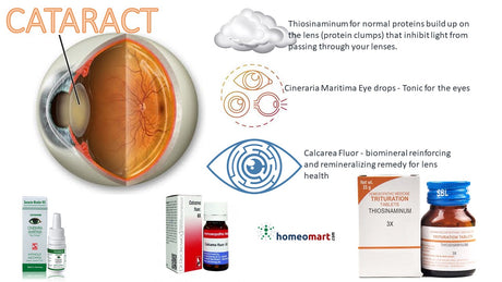 improve cataract vision  homeopathy tablets and drops