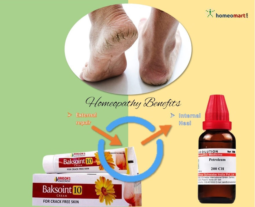 Cracked Heel Cream For Relief And Repair Of Heels, 100 Grams at Rs  750/piece in Hyderabad