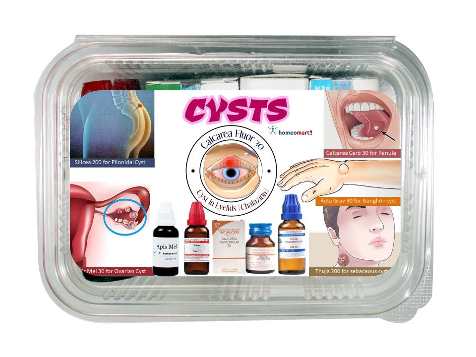 Cyst treatment homeopathy medicines
