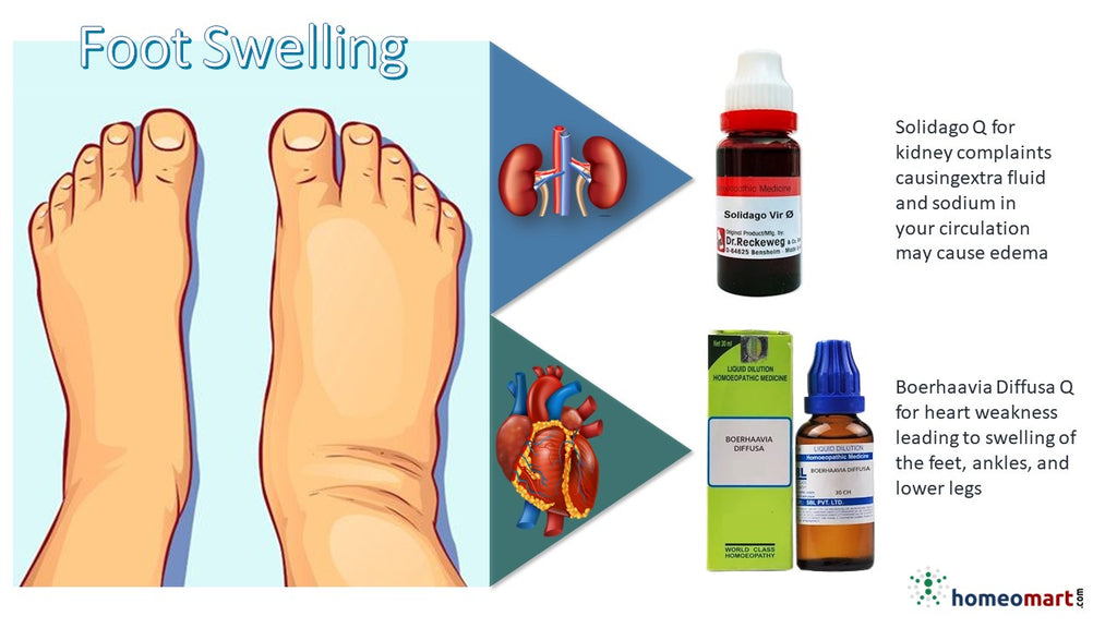 How to reduce swelling in feet 
