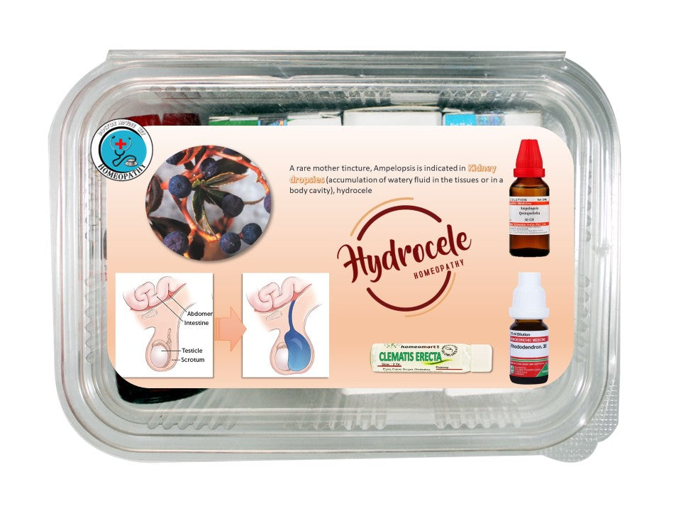 hydrocele treatment in homeopathy medicine kit