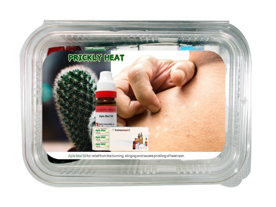 Prickly Heat Treatment Homeopathy Medicines for adults and children