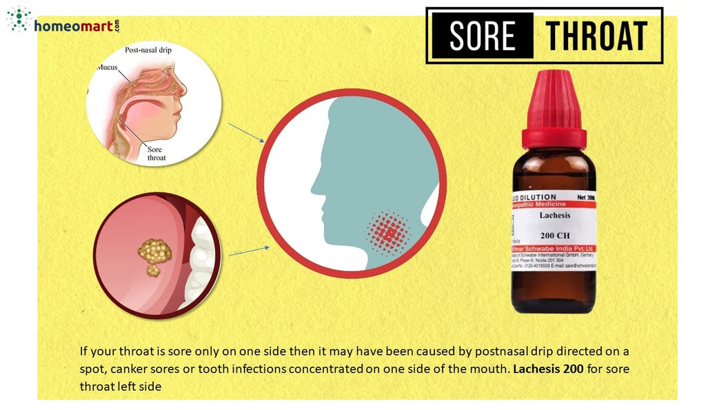 Top Homeopathy Sore Throat Medicines By Symptoms In Pills Drops top-homeopathy-sore-throat-medicines-by-symptoms-in-pills-drops