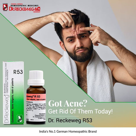 teenage acne, puberty acne, back acne, facial acne treatment